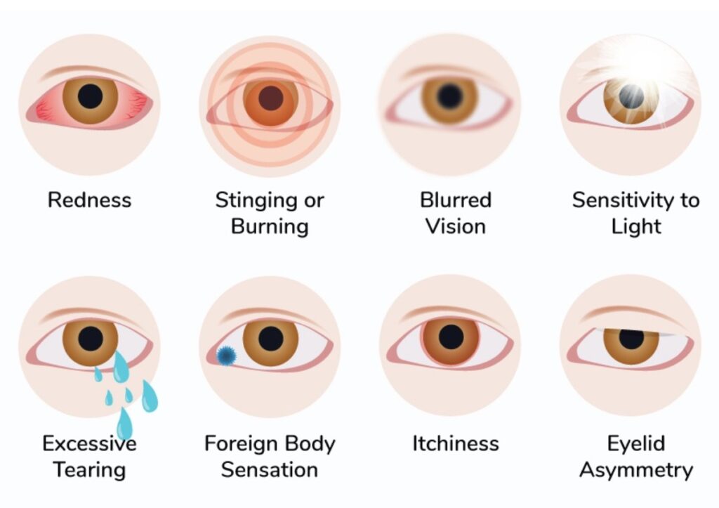 Dry eyes, eye strain, blurry vision: 8 common eye symptoms and what they  mean - CNET